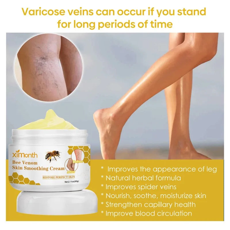 ApiLift™ | Bee Venom Varicose Vein Cream