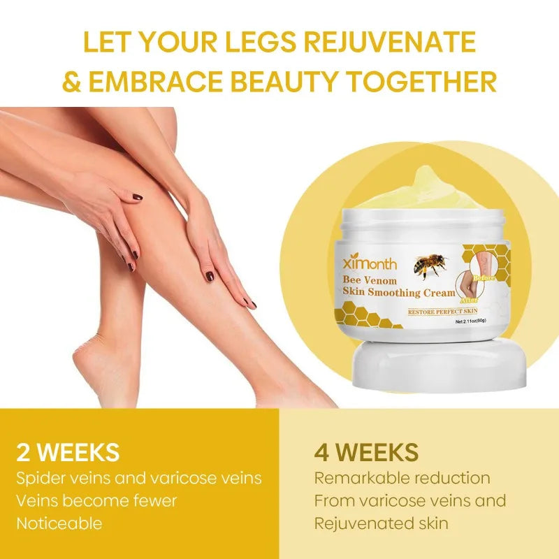 ApiLift™ | Bee Venom Varicose Vein Cream